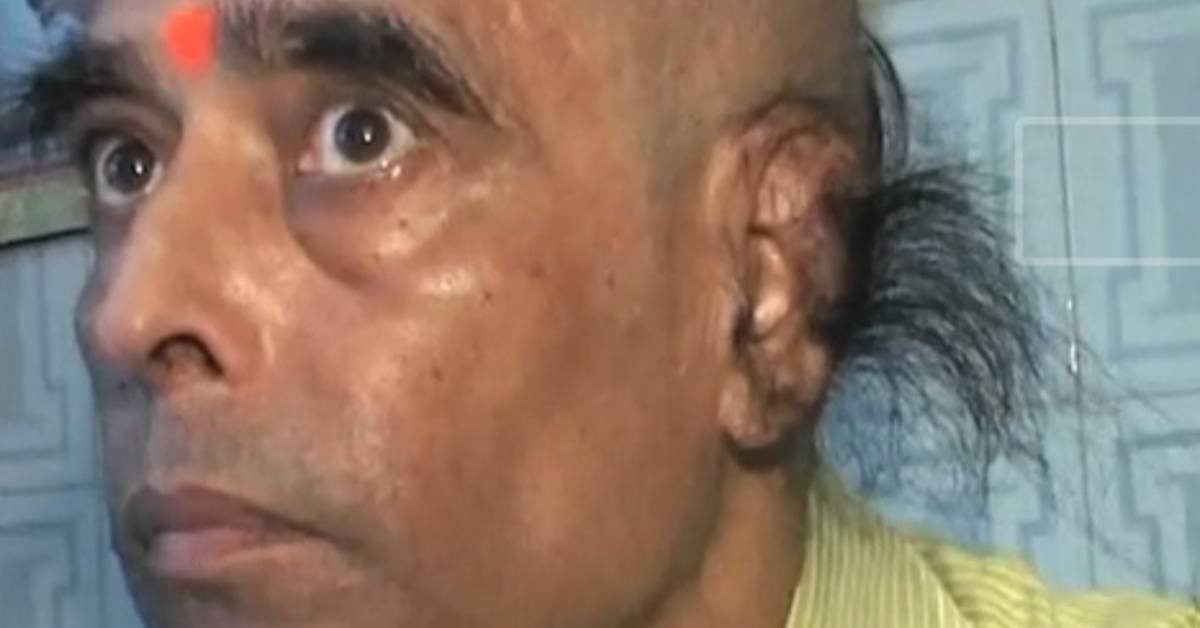 Cet homme a les poils d'oreille les plus longs au monde ! Coiffure