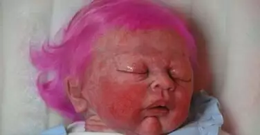 Scandaleux ! Elle colore les cheveux de sa fille de 2 mois, qui fait une réaction allergique !