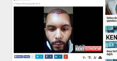 Un djihadiste français arrêté à cause d'une greffe de cheveux !